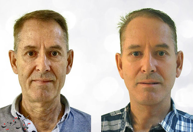 ۷ راه ساده اما موثر در پیشگیری از افتادگی پوست